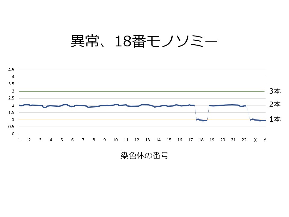 染色体異常、18番モノソミー