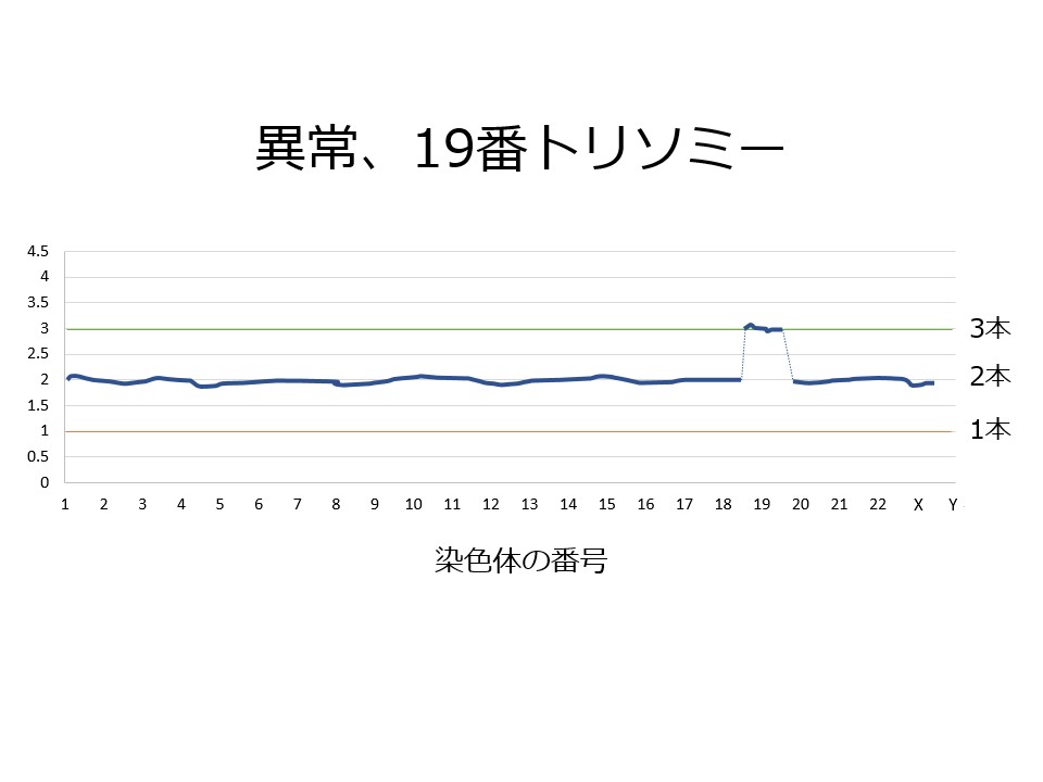 染色体異常、19番トリソミー
